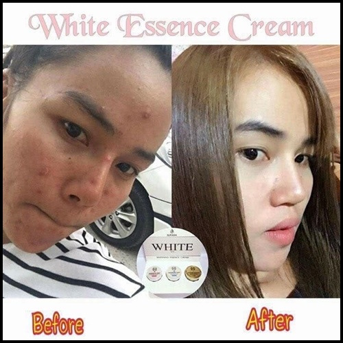 ยูวี ซิลิโคน ฟาวเดชั่น UV Silicone Foundation