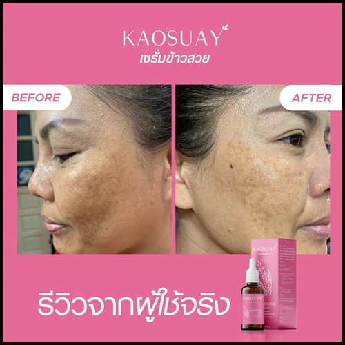 เซรั่มข้าวสวย Kaosuay ลดฝ้า กระ