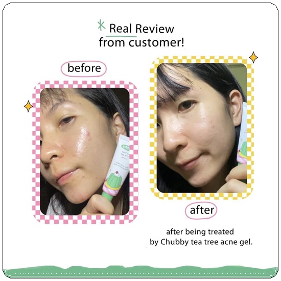 เจลแต้มสิวชับบี้ Chubby Tea Tree Acne Gel
