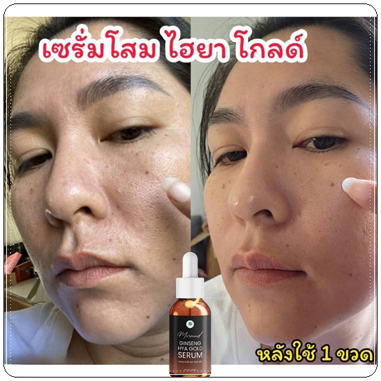 เซรั่มโสมทองไฮยา Ginseng HYA Gold Serum Mermaid