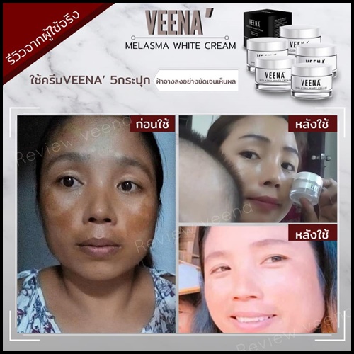 วีน่า เมลาสมา ไวท์ ครีม VEENA Melasma White Cream