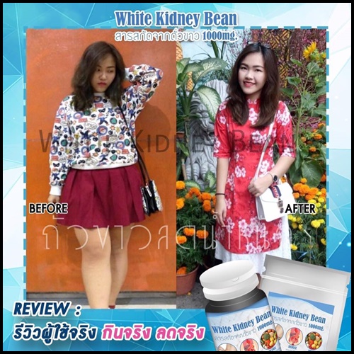 ถั่วขาวลดน้ำหนัก White Kidney Bean