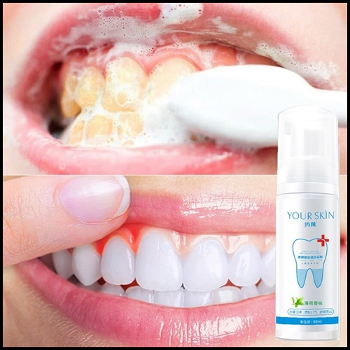 มูสโฟมฟอกฟันขาว Your Skin Teeth Whitening Mousse Foam