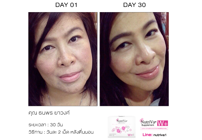 ผลิตภัณฑ์เสริมอาหาร นูทริว่า (NutriVa W+ SOD)