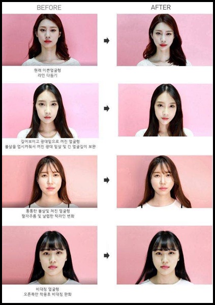 Dodo Label พลาสเตอร์หน้าเรียว