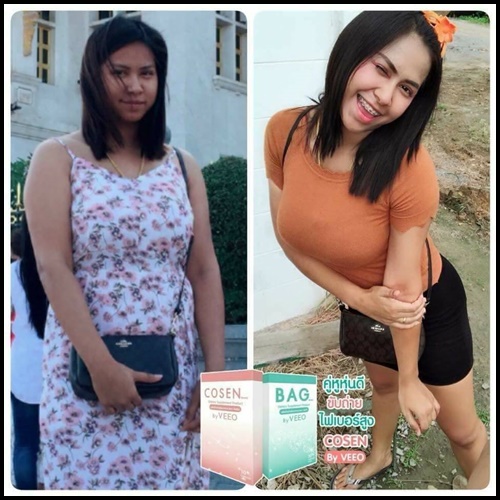 BAG by VEEO อาหารเสริมช่วยกระตุ้นระบบขับถ่าย