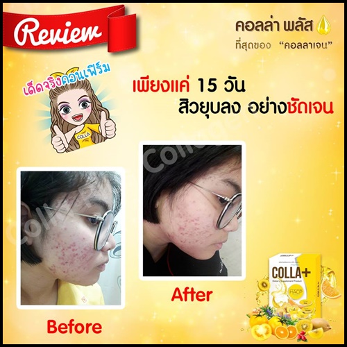 คอลล่า พลัส Colla+ Hacp