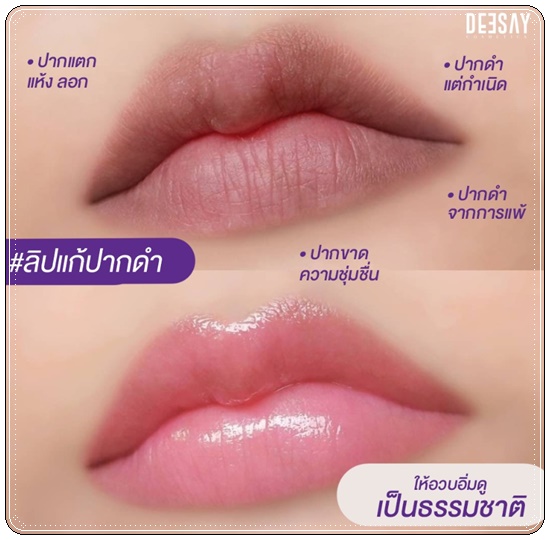 ลิปแก้ปากดำ Deesay Lip Repair Serum ลิปรีแพร์เซรั่ม