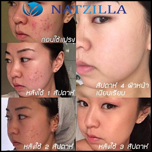 แปรงล้างหน้า Natzilla Deep Cleansing Facial Brush