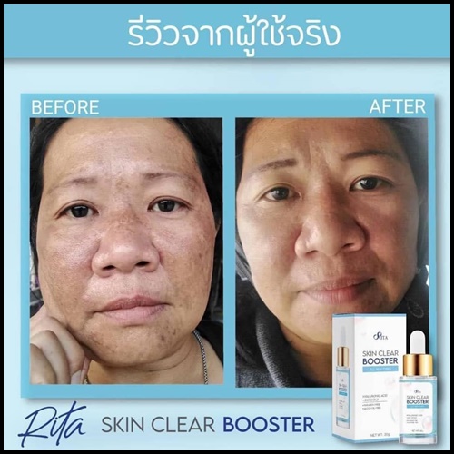 เซรั่มริต้า Rita Skin Clear Booster Serum เคลีย์ สกิน บูสเตอร์