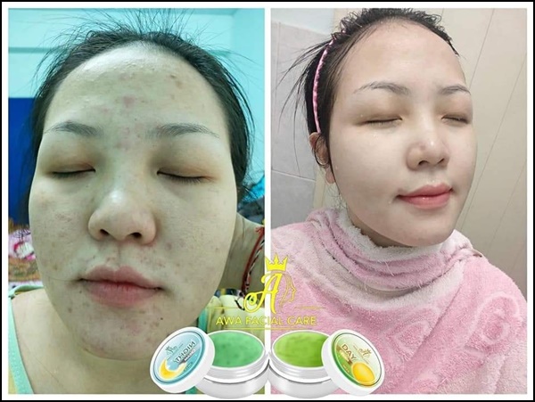 ครีมเอวา AWA Facial Care (ส่งฟรี)