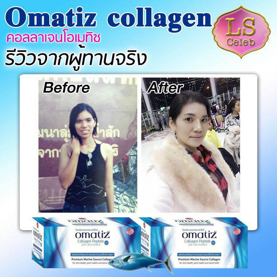 โอเมทิซ คอลลาเจน แบบซองใหม่ (LS Omatiz Collagen Peptide)
