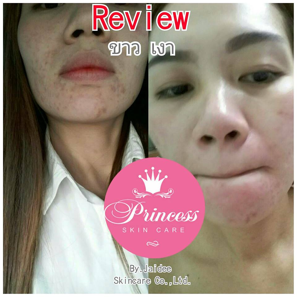 ครีมหน้าขาว หน้าเงา หน้าเด็ก by Princess White Skincare (แบบใหม่)