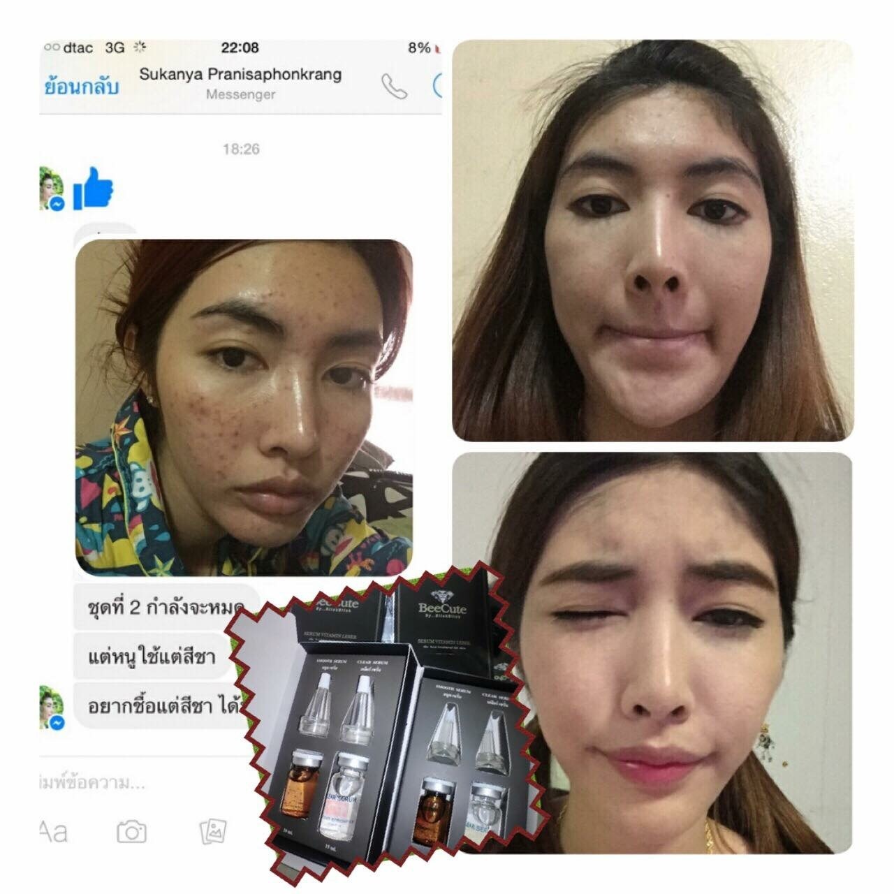วิตามินเลเซอร์หน้าใส (Serum Vitamin Leser Beecute By BllnkBllnk)