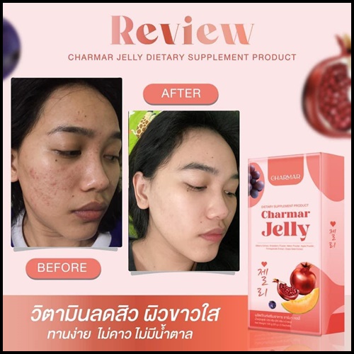 เจลลี่คอลลาเจน ชาร์มาร์ Charmar Jelly เจลลี่ผิวขาว (ของแท้)