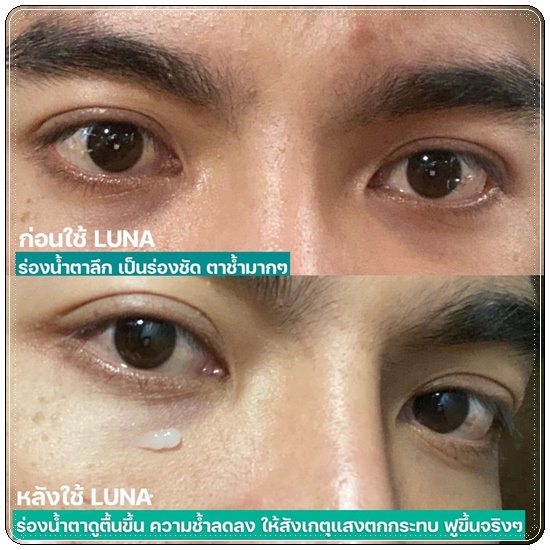 LUNA JELLY EYE CARE ลูน่า เจลลี่ อาย แคร์