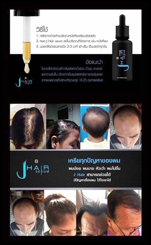เจแฮร์ เซรั่ม J-Hair Serum เซรั่ม ปลูกผม ปลูกหนวด by จอนนี่ แอนโฟเน