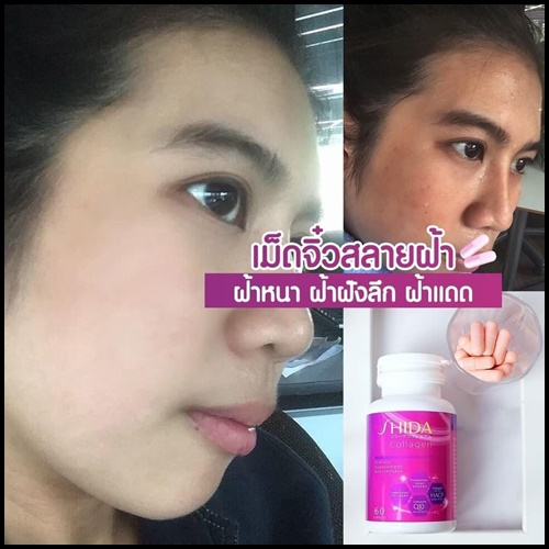 ชิดะคอลลาเจน Shida Collagen