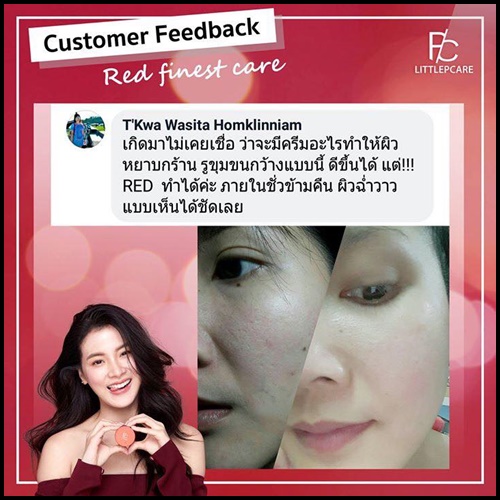 ครีมบำรุงเรด ไฟเนสต์ แคร์ Red Finest Care by Pcare Skincare