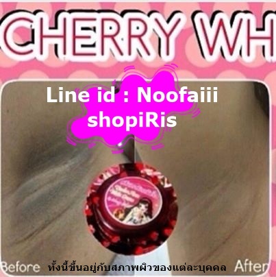 ครีมรักแร้ หัวนมชมพู cherry white