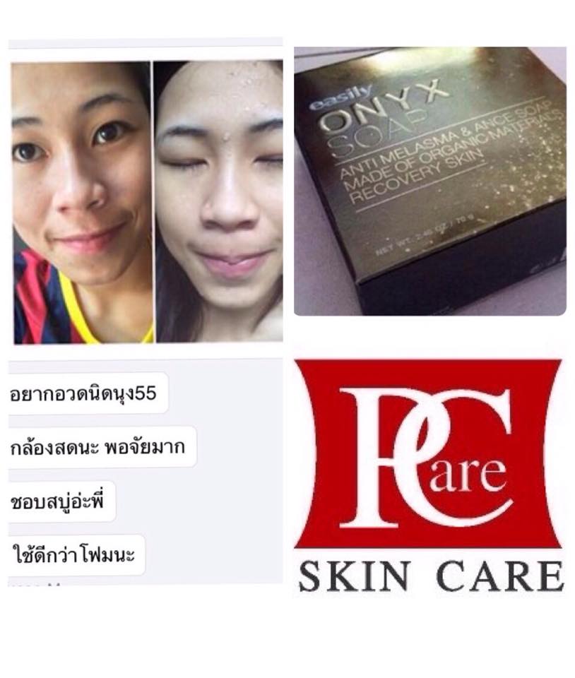 สบู่โอนิกซ์ Onyx สบู่รักษาสิว