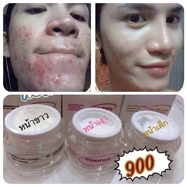 ครีมหน้าขาว (Princess White)