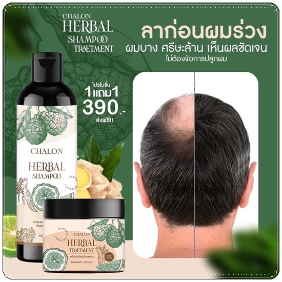 แชมพูมะกรูดชลอน Chalon Herbal Shampoo (แถมฟรี ทรีทเม้นชลอน)