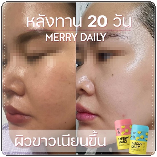 Merry Daily วิตามินเร่งขาวลดเครียด (ของแท้)