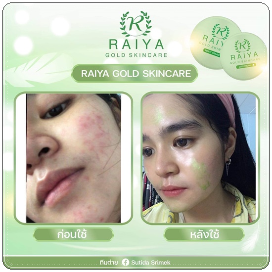 ครีมไรยา Raiya Gold Skincare