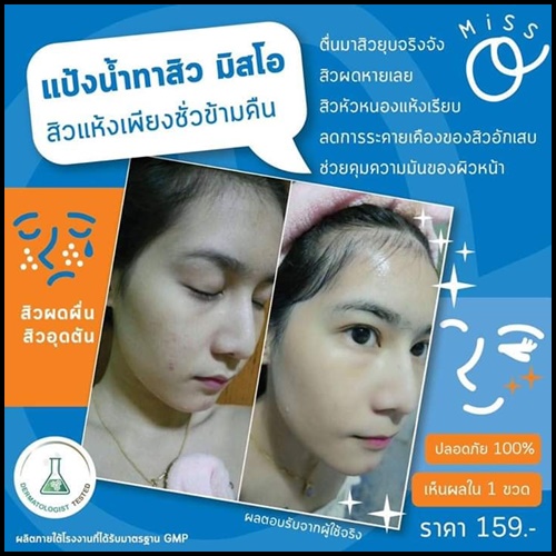 แป้งน้ำทาสิว มิสโอ Miss O Acne Powder Lotion