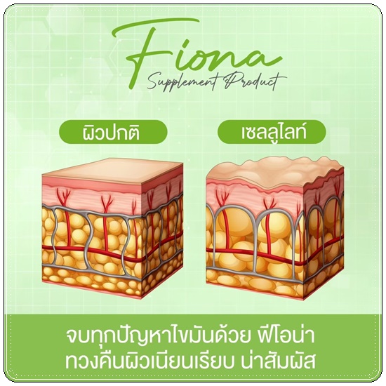 Fiona Glam Mercia ฟิโอน่า