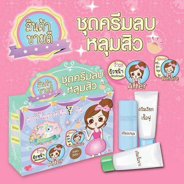 ชุดครีมลบหลุมสิว By Punlapa
