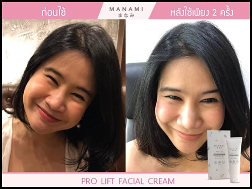 Manami Pro Lift Facial Cream ครีมหน้าเรียว ยกกระชับผิว