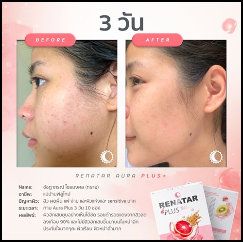 เรนาต้า ออร่าพลัส RENATAR AURA PLUS+ คอลลาเจนผิวใส