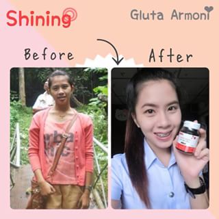 ขาย แอลกลูต้าอาโมนิ L-Gluta Armoni Red Fruit โปรโมชั่น ส่งฟรี EMS