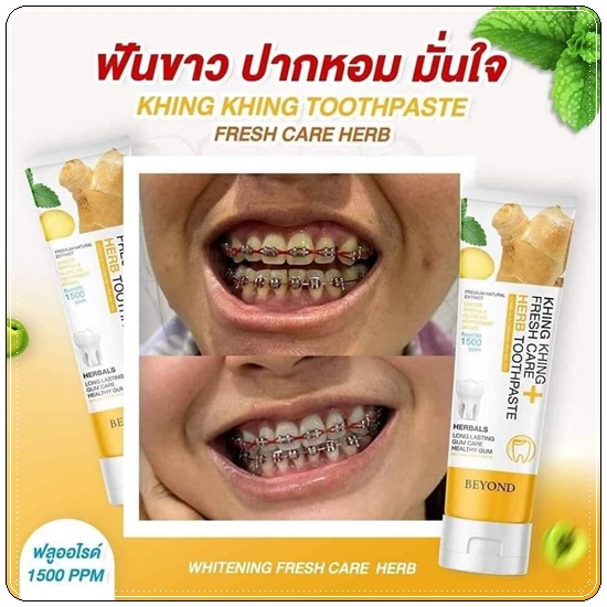 ยาสีฟันขิงขิง Khing Khing Fresh Care Herb Toothpaste ยาสีฟันบียอน (1แถม1)