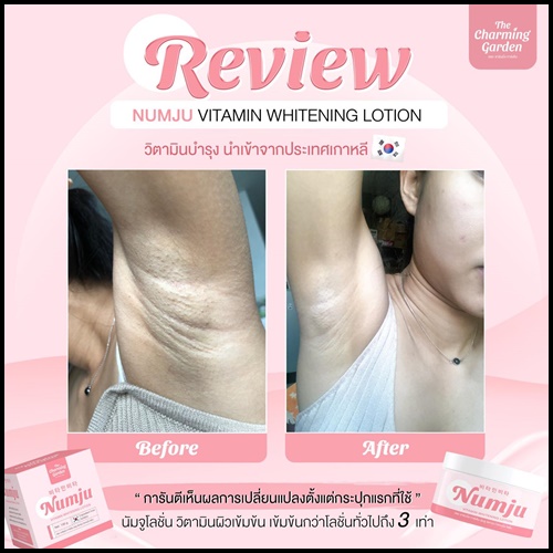 นัมจู หัวเชื้อวิตามินเกาหลี Numju Vitamin Whitening Lotion