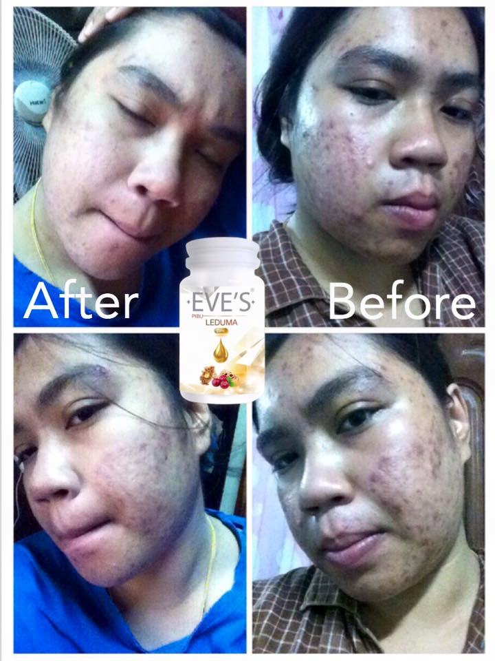 Pibu Gluta Plus New By EVE'S ผสมนมผึ้ง ลดสิว บาย อีฟ