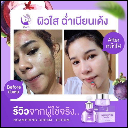 เซ็ตงามพริ้ง Ngampring ครีมงามพริ้ง แถมฟรี เซรั่มงามพริ้ง (1แถม1)
