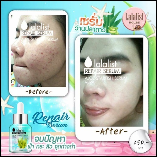 เซรั่มว่านปลาดาว Lalalist Repair Serum