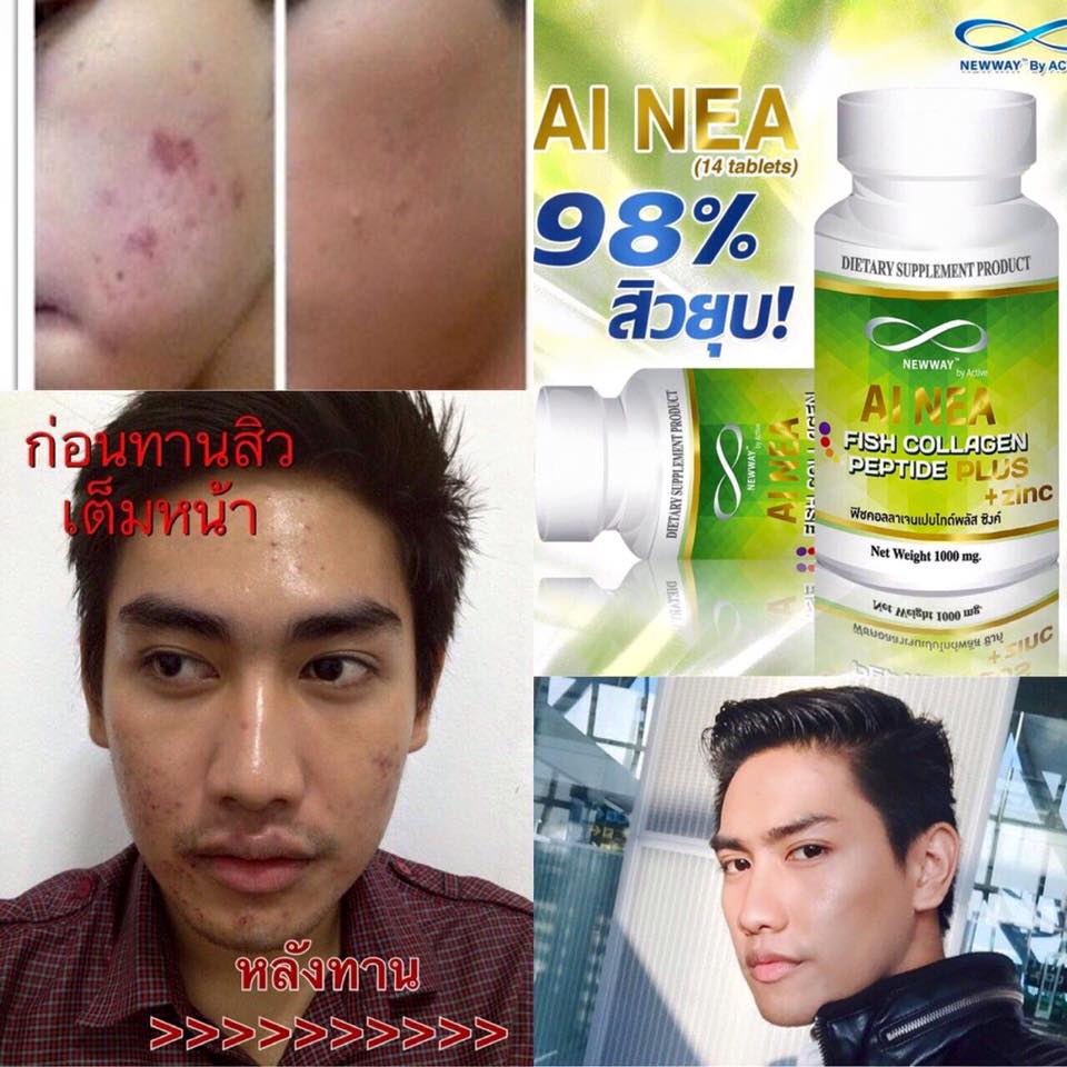 นิวเวย์ไอเน่ คอลลาเจน ลดสิว โปรส่งฟรี EMS (NEWWAY Ai Nea Collagen Peptide Zinc)