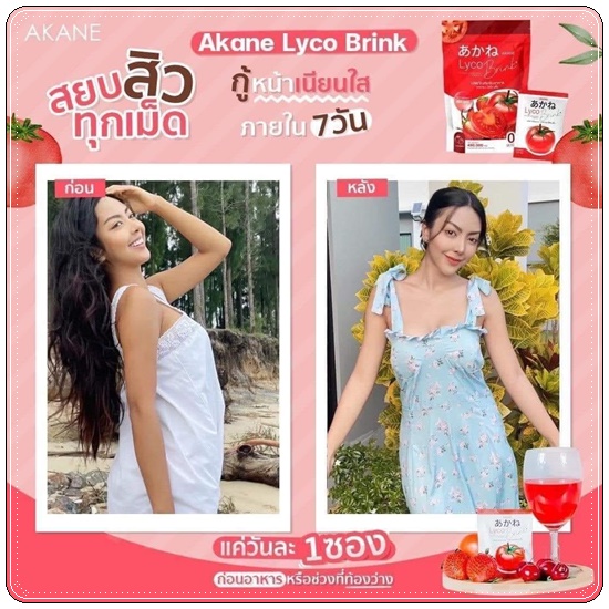 อากาเนะไลโคบริ้ง Akane Lyco Brink (ส่งฟรี)