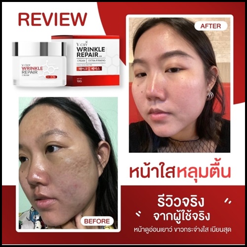V-CHY Wrinkle Repair Cream วีชี่ ครีมโบท็อกซ์ ของแท้ ส่งฟรี