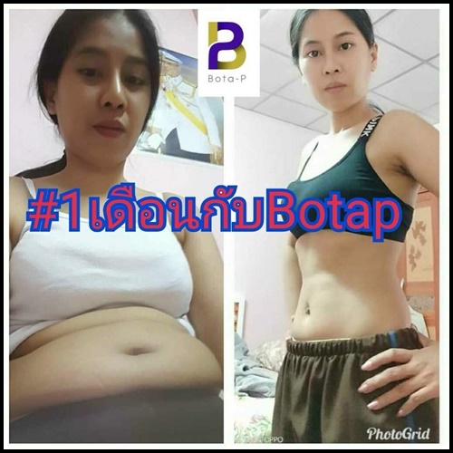 โบต้าพี โปรตีนจากเมล็ดถั่ว BOTA-P Protein