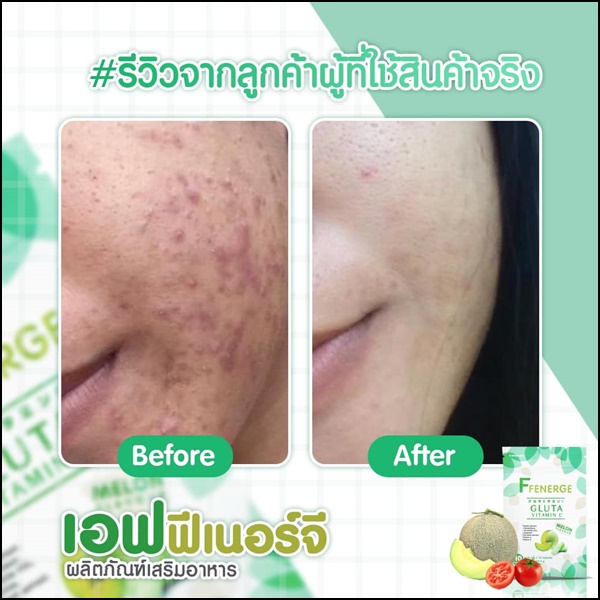 เอฟฟีเนอร์จี กลูต้า FFenerge Gluta Vitamin C กลูต้าเมล่อน (ส่งฟรี)