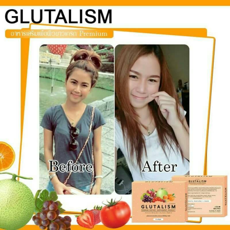 Glutalism กลูต้าลิซึ่ม by Maximize 10 แคปซูล