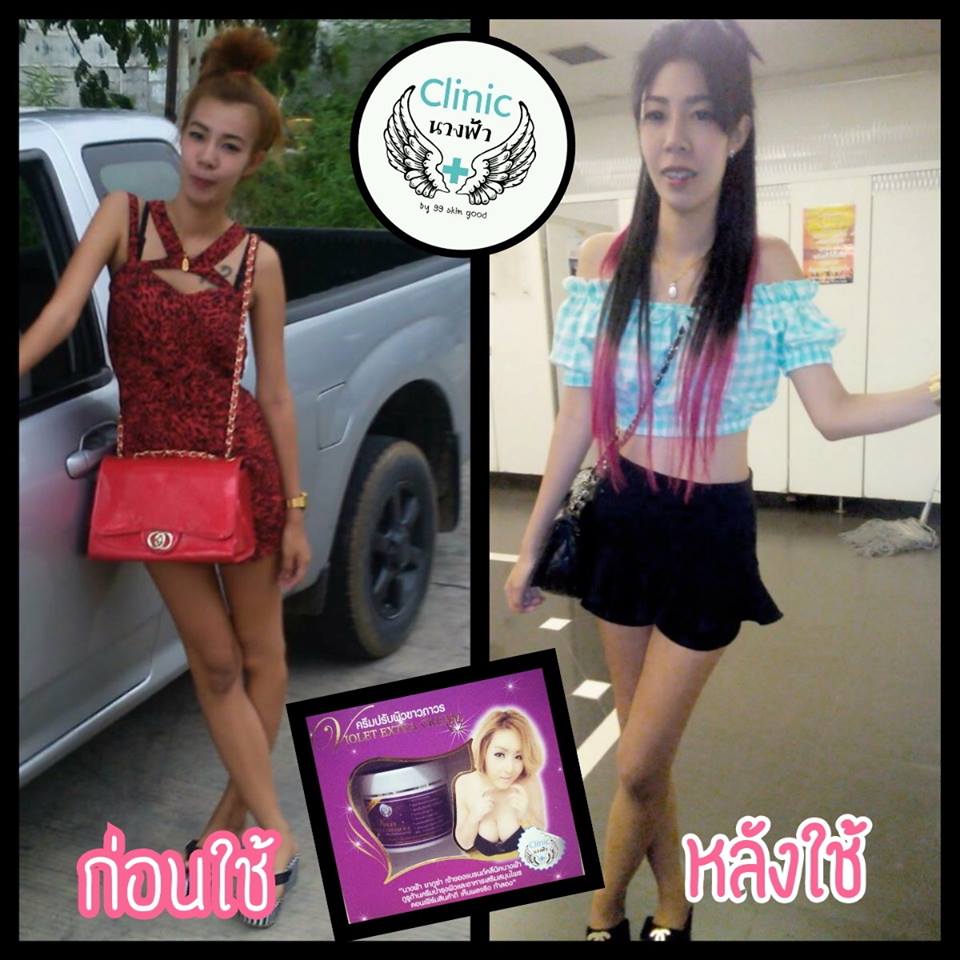 violet Lotion by คลีนิคนางฟ้า