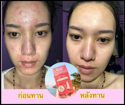 โคโม๊ะ คอลลาเจน ซีพลัส Como Collagen C+