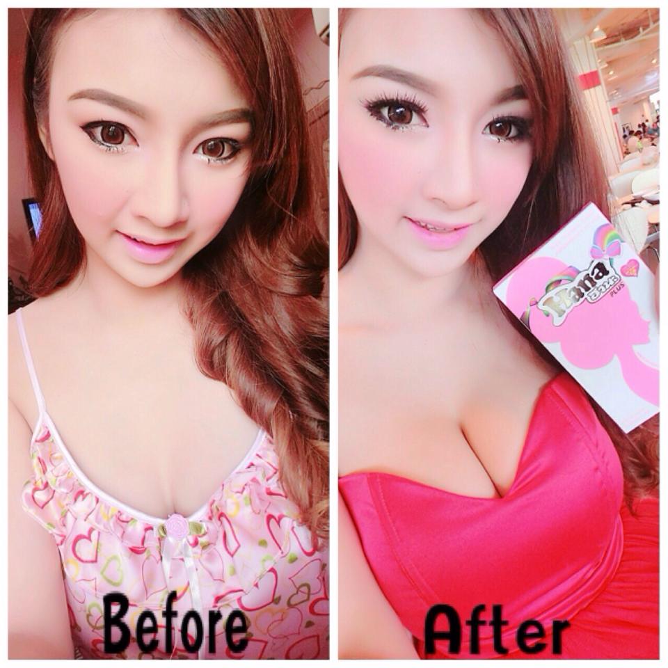 Hana Girl Plus อาหารเสริมสำหรับผู้หญิง