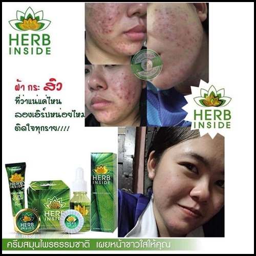อภิมหาโชค เฮิร์บโกลด์ Herb Gold
